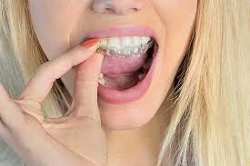 Our dental clinic in eltham has been carefully designed to be comfortable for the whole family. Dental Treatments Dental Services Eltham Ferrari Dental