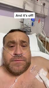 Double Amputee Stump Man