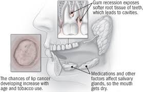 It all depends on how much if any damage there was to the tooth, including the nerve to the tooth. The Aging Mouth And How To Keep It Younger Harvard Health