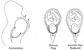 Your labour may not start for hours or even days after you lose the mucus plug. Your Special Baby Real Lamaze Prepared Childbirth