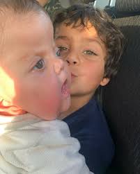 Sindrome de Apert 💘 del miedo pasamos a los ojos llenos de esperanzas y al  pecho muy inflado.