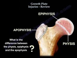 Image result for Growth Plate