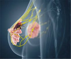 Forscher Heizen Mammografie Debatte An