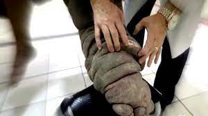 Check spelling or type a new query. Pengertian Endemik Dan Contoh Penyakitnya Hot Liputan6 Com