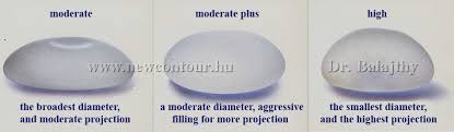 mentor breast implants size chart best picture of chart