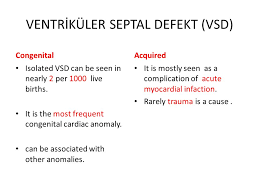 ventricular septal defect vsd ppt video online download