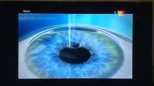 I would recommend the centre for sight to anyone looking to improve the vision. Home Kpj Centre For Sight Cute766