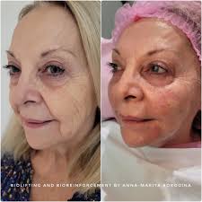 Safi Miran Rejuvenation Center Denver