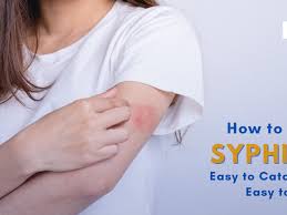 Image result for syphilis symptoms