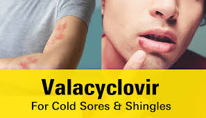 Image result for Valacyclovir