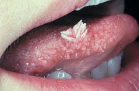 Image result for Centrostigma papillosum