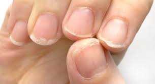Endlich Lange Und Gesunde Fingernagel Miracle Nails Super Nagelharter Nagellack Haare Und Nagel Nagelpflege