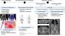 "Cáncer de próstata" "inteligencia artificial" IA de translate.google.com
