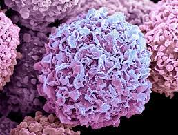 Information on authorship and revision. Survival Following Mastectomy Vs Breast Conserving Surgery Plus Radiotherapy Cancer Therapy Advisor
