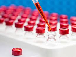 We did not find results for: Antibody Titer Test Purpose Procedure And Preparation