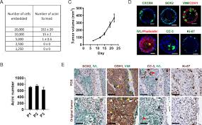 This article aims to explain how cancer arises. Cancer Associated Fibroblasts Suppress Sox2 Induced Dysplasia In A Lung Squamous Cancer Coculture Pnas