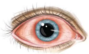 Image result for Ciliary Flush