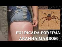 A picada não costuma ser sentida. Picada De Aranha Marrom Youtube