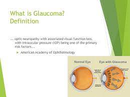 It can occur at any. Glaucoma Workup Review From A To Oct Ppt Video Online Download