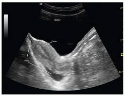 Pocus Guide - Emergency Medicine Guidewire