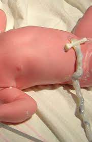 Fungsi dari tali pusat adalah menjaga viabilitas (kelangsungan hidup) dan memfasilitasi pertumbuhan embrio dan janin. Facts About The Baby S Umbilical Cord Prenagen