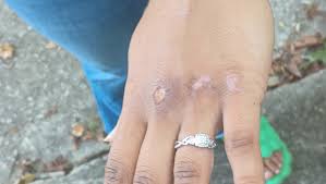 Fundraiser by Holly Bostic : Support LeeAisha's therapy