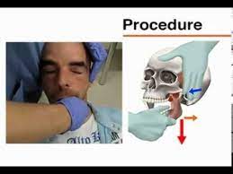 Repositioning Dislocated Temporomandibular Joints Temporomandibular Joint Tmj Muscle Anatomy