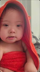 Down Syndrome Innovations