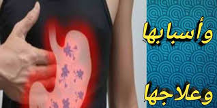 يمكن شرب هذا الخليط قبل العلاقة الحميمة بحوالي ساعة. Ø¹Ù„Ø§Ø¬ Ø­Ù…ÙˆØ¶Ø© Ø§Ù„Ù…Ø¹Ø¯Ø© ÙˆØ§Ù„Ø­Ø²Ø§Ø²