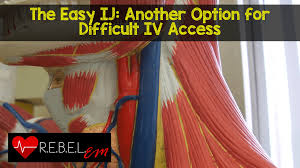 Image result for IV Access