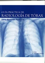 Para encontrar más libros sobre posiciones radiologica, puede utilizar las palabras clave relacionadas : Guia Practica Radiologia Torax Radiologia Radiografia De Torax Enfermeria Pdf