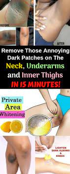 Pin On Health