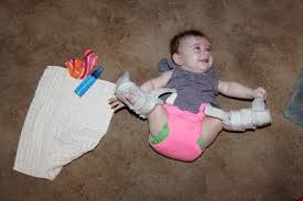 Froggied Princess Our Life With A Wheaton Pavlik Harness Diapering And The Harness Cloth Diaper Hip Babies Baby Scrapbook