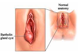 The hairless skin of the inner fold is smoother and contains oil glands called. Vagina Vs Vulva When Passionate Health Wellcare Facebook