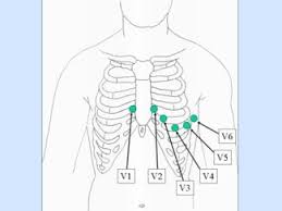 understanding an ecg geeky medics