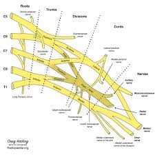 Brachial Plexus Diagram Radiology Case Radiopaedia Org