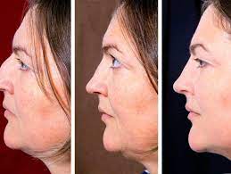 Then place your index fingers on the outer ends of your eyebrows. 5 Facial Yoga Tips To Get Rid Of Your Double Chin The Times Of India