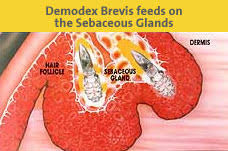 Image result for Demodex brevis