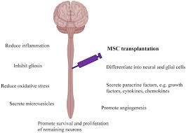 Ming medical services sdn bhd. Treatment Of Spinal Cord Injury With Mesenchymal Stem Cells Abstract Europe Pmc