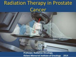 Radiation Therapy In Prostate Cancer