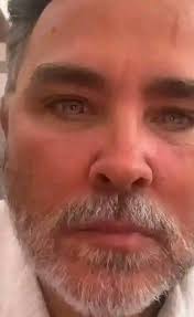 Bella smiling. Dreaming of love and happiness. A basset rescue story🤗😘🐶 