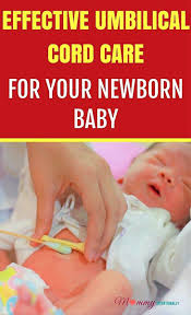 How To Care For A Newborn Umbilical Cord Newborn Care Newborn Baby Care Newborn