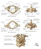 Image result for what happens if someone has a type 2 dens fracture without treatment