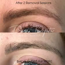 With lack of available land coupled with vacancy rates in the inland empire at historically low levels, the fully entitled land sites were unique in allowing investors to be in the ground immediately, tom money of orbis real estate partners tells globest.com. Saline Removal Is Perfect For Botched Eyebrows Permanent Makeup Removal Permanent Makeup Permanent Eyeliner