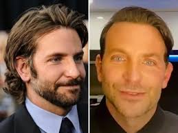 Successivamente ad una forte stempiatura, l'attore americano ha probabilmente deciso di optare per un intervento di autotrapianto di capelli che l'ha portato a . Bradley Cooper Torna Su Twitter Con Un Nuovo Hairstyle In Stile Retro