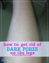 Strawberrylegs Want To Know How To Get Rid Of Darkporesonlegs Here Are The Best Home Remedies For Treating Dark Pores Dark Pores Beauty Hacks Beauty Care