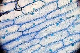 We did not find results for: Onion Cells Under A Microscope Requirements Preparation Observation Plant And Animal Cells Animal Cell Plant Cell