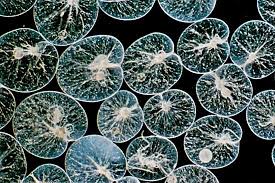 Image result for Pseudopod Ospermum