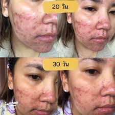 Broken face, addicted to substances