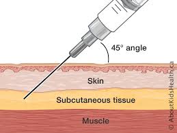 Image result for Subcutaneous Injection